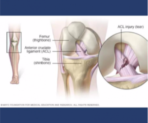 OSSEM - Cruciate ligaments